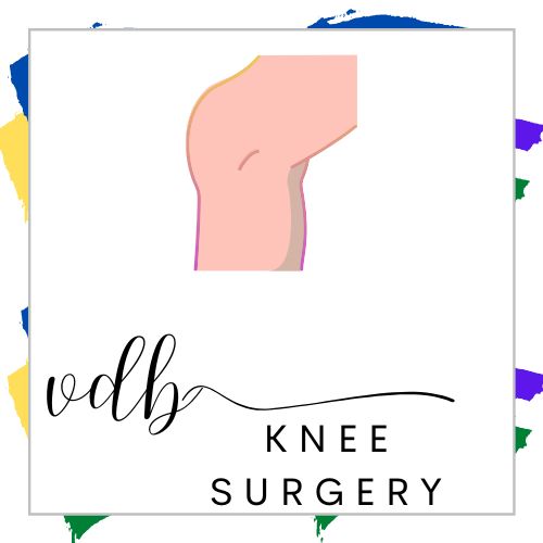 Knee Surgery